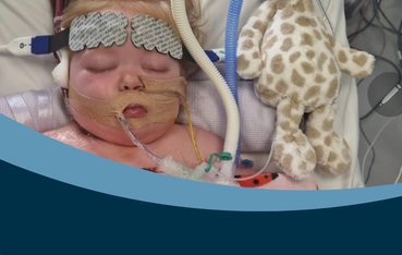A baby lying asleep in hospital with tubes and monitors attached to her face