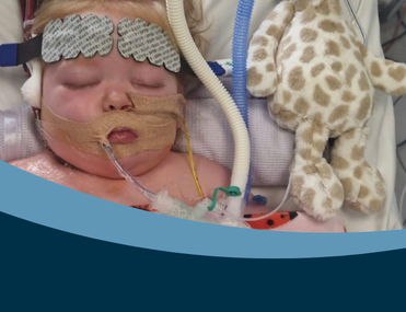 A baby lying asleep in hospital with tubes and monitors attached to her face
